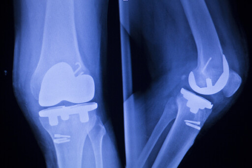 Ceramic Cores for Medical Industry